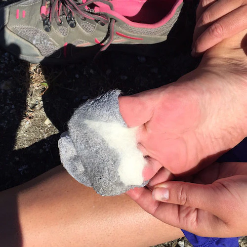 Wool-It (Blister Aid) - Image 4